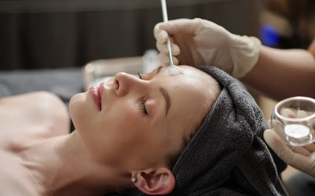What Are the Benefits of Regular Chemical Peel Sessions?